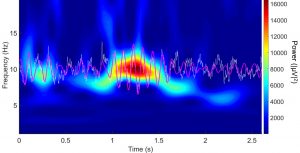 Acoustoelectric Brain Imaging will allow researchers to measure electrical activity in the brain, such as the brain waves that occur during sleep cycles. (Photo courtesy of the University of Arizona)